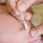 O que deve ser observado no coto umbilical?